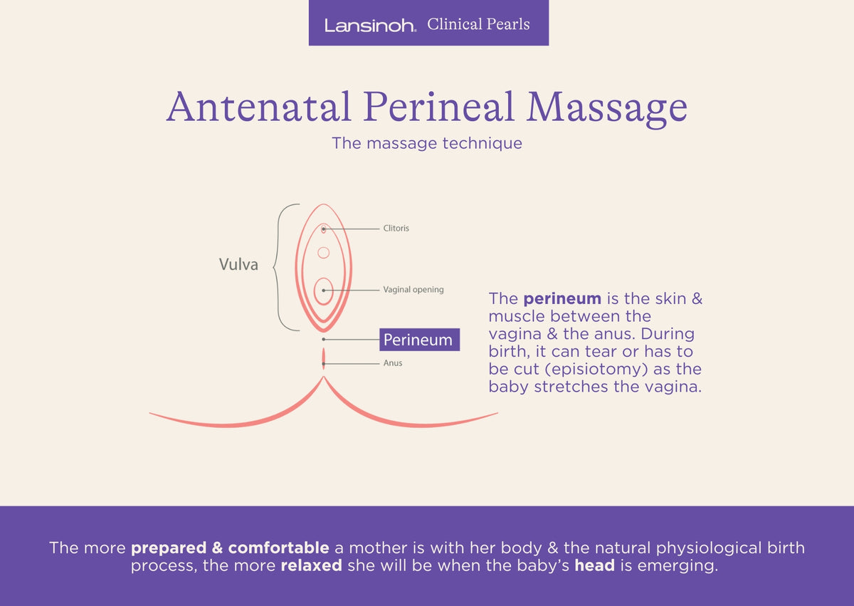 How to Perform Antenatal Perineal Massage (APM) - image 1