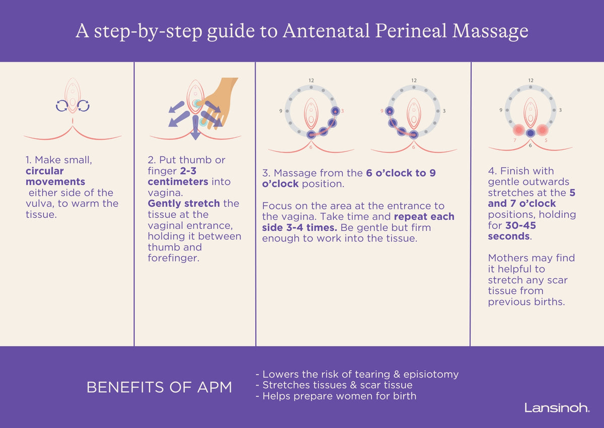 How to Perform Antenatal Perineal Massage (APM) - image 2
